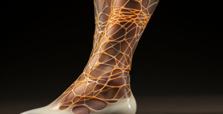 Склеротерапия вен: современное решение проблемы варикозного расширения