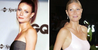 Кому необходима пластика груди?