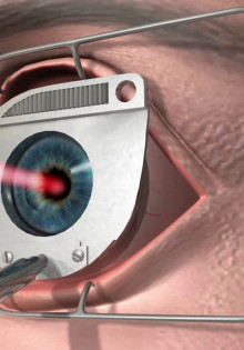 Как работает ЛКЗ