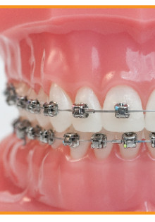 Пилильщика: Лесной Архитектор и Уничтожитель