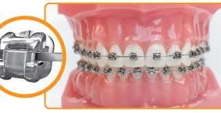 Пилильщика: Лесной Архитектор и Уничтожитель