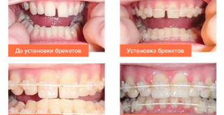 Удивительный мир земноводных: от лягушек до хвостатых красавцев