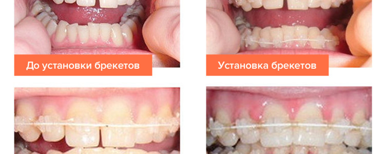 Удивительный мир земноводных: от лягушек до хвостатых красавцев