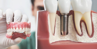 ПРОТЕЗИРОВАНИЕ ЗУБОВ: ЧТО ЭТО И КОГДА НЕОБХОДИМО?