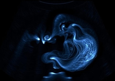 Тромбоэластография в акушерстве: контроль гемостаза во время беременности и родов