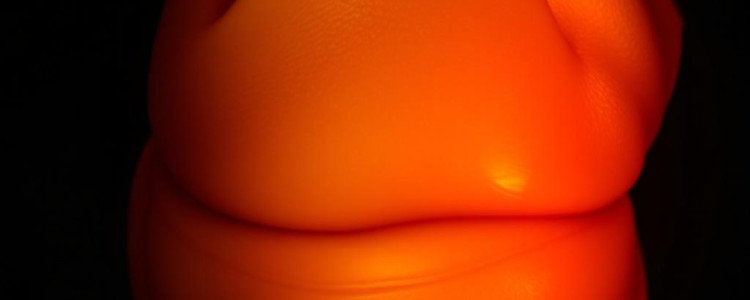 Артроскопия мениска: точная диагностика и бережное лечение в один визит