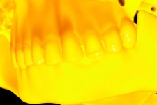 Как искусственный интеллект меняет анализ 2D- и 3D-снимков зубов: революция в стоматологии