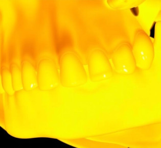 Как искусственный интеллект меняет анализ 2D- и 3D-снимков зубов: революция в стоматологии
