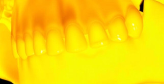 Как искусственный интеллект меняет анализ 2D- и 3D-снимков зубов: революция в стоматологии