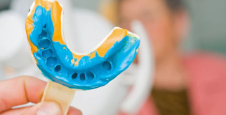 Протезирование зубов в Москве