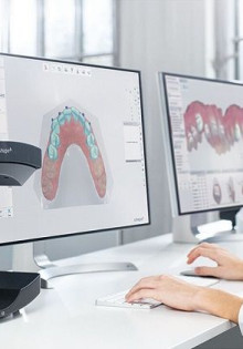 Стоматологические лабораторные сканеры: технологии будущего