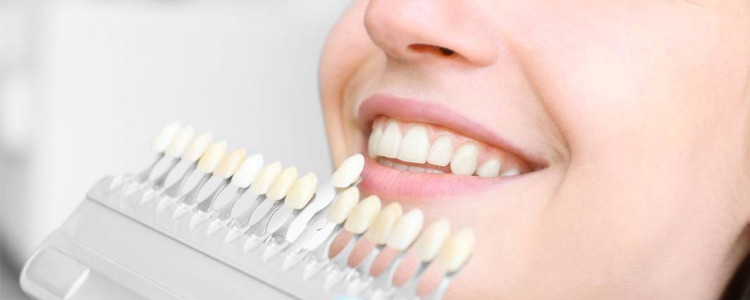 Отбеливание зубов: эффективные и безопасные технологии