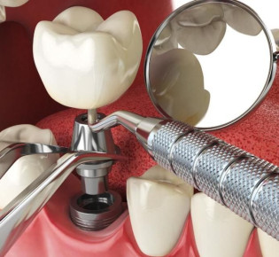 От чего зависят цены на стоматологические услуги?
