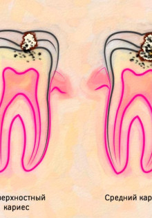 Цианея: Удивительный мир медуз, которых стоит поблагодарить за их красоту и уникальность