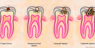Цианея: Удивительный мир медуз, которых стоит поблагодарить за их красоту и уникальность