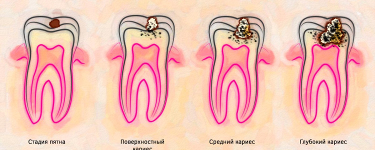 Цианея: Удивительный мир медуз, которых стоит поблагодарить за их красоту и уникальность