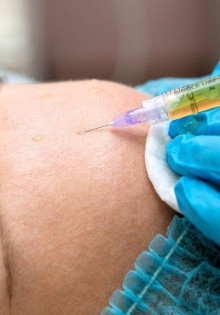 Что представляет собой плазмолифтинг лица?