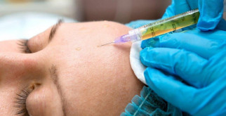 Что представляет собой плазмолифтинг лица?