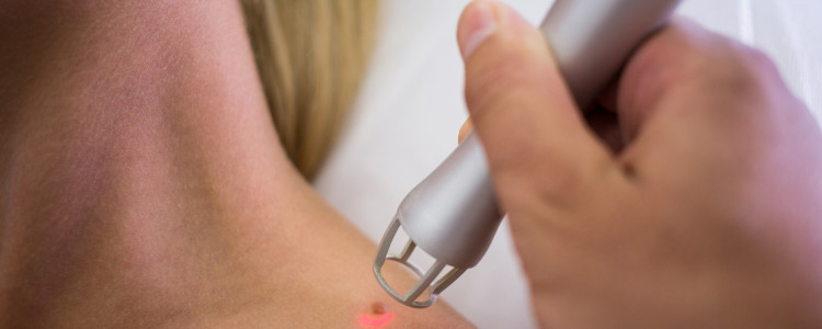 Почему папилломы требуют внимания