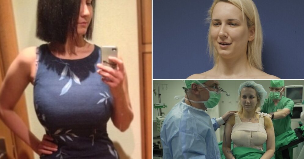 Светлана иванова сделала маммопластику до и после фото